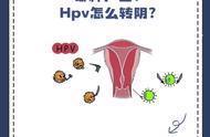 hpv18和hpv56哪个更严重（hpv18和hpv56都是阳性应该怎么办）