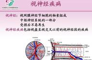 色弱有什么办法恢复正常（色弱恢复最有效的方法）