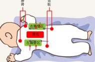 帮助病人咳嗽咳痰正确的拍背方法（咳嗽拍背正确方法图片）