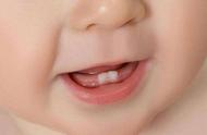 婴儿快出牙的牙龈图片（婴儿快出牙时牙床是什么样子）