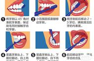 巴氏刷牙法的正确步骤（正确刷牙的八个步骤图）