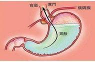 胃酸的作用主要有哪些（胃酸的生理作用包括哪些）