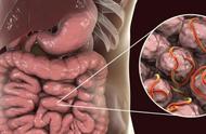 肠道内的微生物与疾病的关系（肠道微生物与哪些疾病有关系）