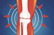 保护膝盖的八种方法（保护膝盖小妙招）
