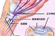 手指恢复断裂神经的最好方法（手指神经断裂康复锻炼）