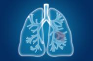 肺慢性炎症是肺炎吗（肺部有慢性炎症怎么办）