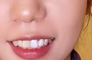 牙齿美白笔怎么用视频（牙齿美白仪器怎么使用）
