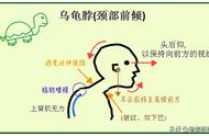 颈椎病最好锻炼办法（颈椎病有哪些锻炼方法）