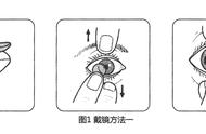 角膜塑形镜的佩戴详细步骤（角膜塑形镜正确使用方法图解）