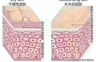 脸部极度缺水敷面膜刺痛怎么补水（皮肤很缺水敷补水面膜会刺痛吗）