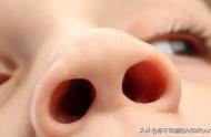 正常鼻腔内部高清图片(第1页)（鼻炎鼻腔内部高清图片）