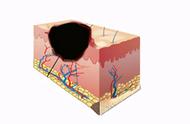 伤口结痂变黑了是怎么回事（伤口结痂变黑是怎么回事）