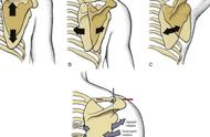 肩胛骨疼痛的锻炼方法（肩胛骨疼痛是怎么锻炼）