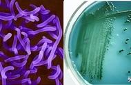 培养霍乱弧菌最佳的培养基是（最适合霍乱弧菌生长的培养基）