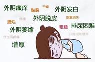 最近一到晚上身上就痒（晚上身上痒要警惕四种疾病）