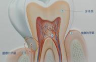 牙洞里黑色物质是什么（堵牙洞的黑色物质是什么）