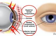 眼球结膜解剖图（眼部结膜结构示意图）