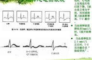 醛固酮高怎样降下来（醛固酮增多症自愈方法）